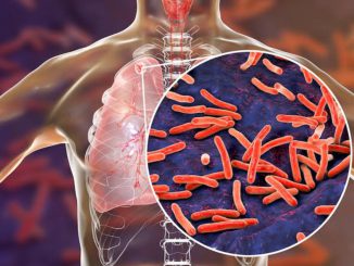 World Tuberculosis (TB) Day! A Lethal Contagious Disease; Check Symptoms