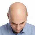 Bald Man Head