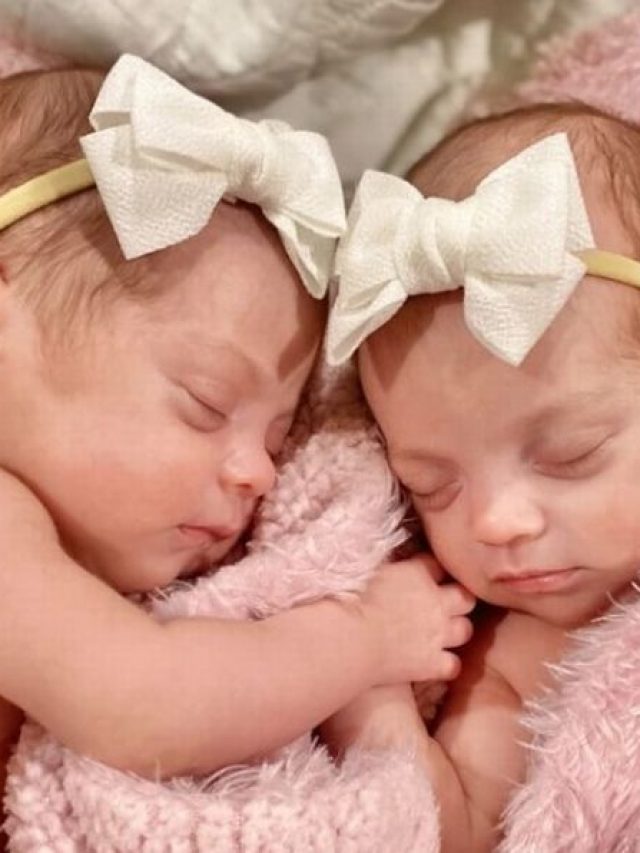 Pics: Very Rare MoMo Twins found in the United States