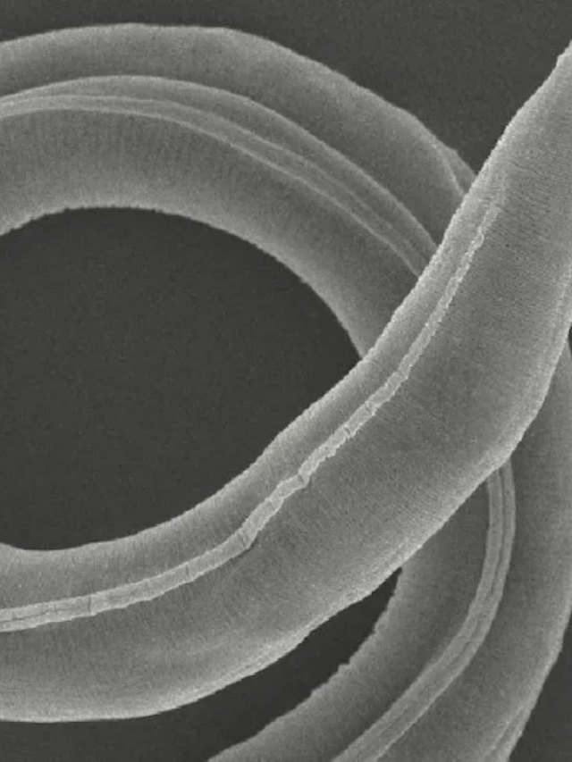 Microscopic worms preserved for 46,000 years in Siberian permafrost were brought back to life!by scientists!