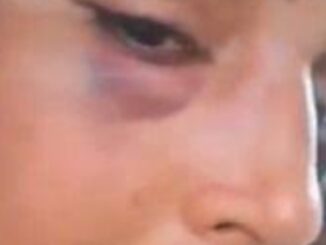 Seema Haider Assaulted: Viral Video Shows Bruised Lip and Eye – What Happened?